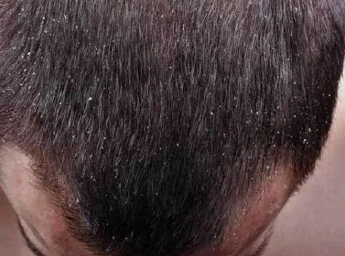 Hair cleansing
